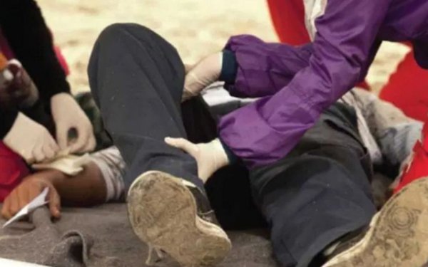 Както показва практиката, всеки повече или по-малко сериозен инцидент рядко минава без фрактури. Фрактурите се делят на отворени и затворени. Ако жертвата има силна болка, рязко увеличаване на болката при движение или опит да се облегне на увредения крайник, деформация и подуване на мястото на нараняване, определено може точно да се диагностицира затворена фрактура.

При открита фрактура се наблюдава деформация и подуване на крайника на мястото на нараняване, а костните фрагменти понякога излизат от раната. Раната трябва да се обработи и да се постави шина, която да се фиксира зад ставата над и под мястото на нараняване. Просто не поставяйте костни фрагменти сами - без необходимите знания е по-лесно да навредите, отколкото наистина да помогнете.