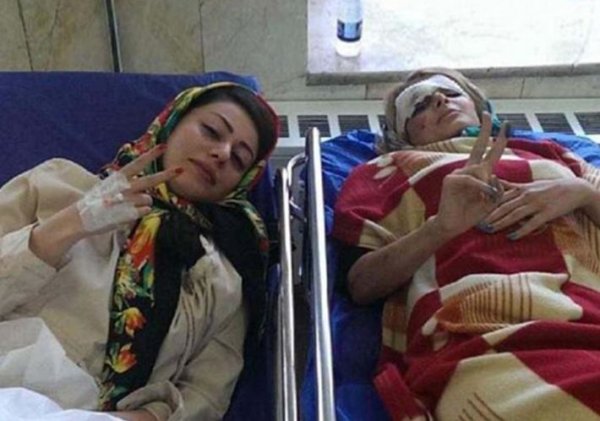 Тази история е от Средния Изток, където две девойки си спретват караоке, докато пътуват. Проблемът е, че не знаят наизуст текстовете на песните и ги четат от мобилните си телефони. Момичето зад волана не вижда, че автомобилът пред нея намалява скоростта, а нейната приятелка също е заета да предава на живо изпълнението им в Instagram. Следва удар, при който двете девойки са леко ранени. Те обаче запазват оптимизма си и в болницата, откъдето активно публикуват селфита.