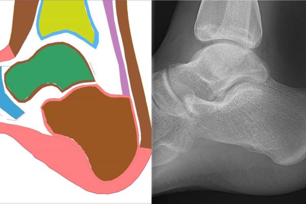 Центърът за съвместни изследвания на безопасността (CSRC) на Toyota започва четири нови проекта за биомеханични изследвания. Те изучават разликите в нараняванията между мъже и жени, както и при различни възрастови групи. Това са технологии, които могат да помогнат да предвидят кога водачът е изложен на риск от увреждане и как по-добре да превключват между автономен и &bdquo;човешки&ldquo; режим на управление. За откриване на разликите в нараняванията изследователите ще използват комбинация от компютърно моделиране, експерименти с тъкани и данни от медицински образци.