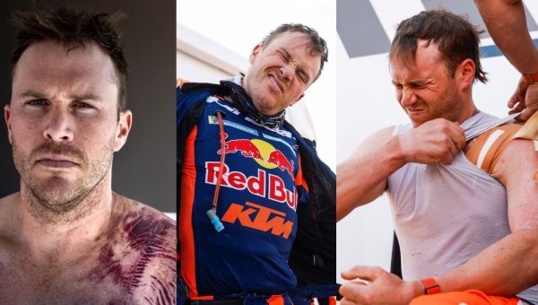 Миналогодишният победител при мотоциклетите изглеждаше уверено запътил се към нова титла, водейки в класирането след 9-ия етап. В 10-ия обаче Сандърс катастрофира и си счупи ключицата. Злополуката го извади още тогава от битката за подиума. Но австралиецът стисна зъби и в последните три етапа продължи да кара - с една ръка. И завърши пети. "Питаха ме защо карам с такава болка", обясни Сандърс, който между етапите трябваше да се кисне в импровизирани вани. "Но болката от това да не завърша щеше да е много по-голяма". Заради такива хора Дакар си остава Дакар. След финала Сандърс тръгна към болницата, за да бъде най-после опериран. 
